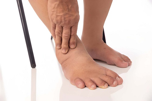 Best Diabetic Foot Treatment in Andheri, Mumbai